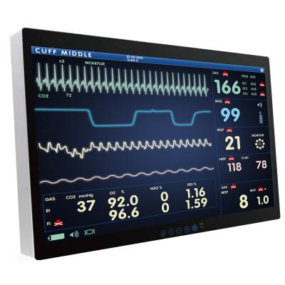 Onyx ACCEL Panel PC 32” 4K UHD Smart View AMD Ryzen Embedded V1000 Multi-Touch Surgical Stat