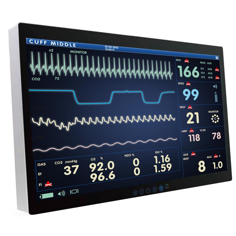 Onyx ACCEL Panel PC 32&rdquo; 4K UHD Smart View AMD Ryzen Embedded V1000 Multi-Touch